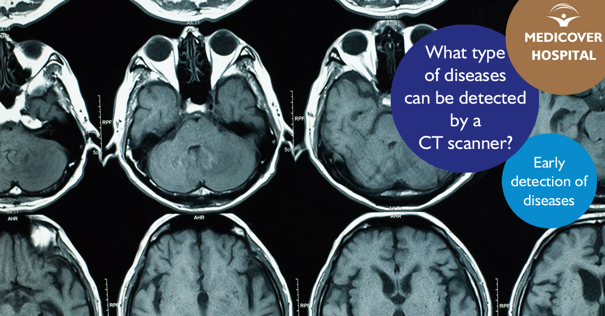 Korhaz_FB_1200x628_CT-scan-diseases_170629