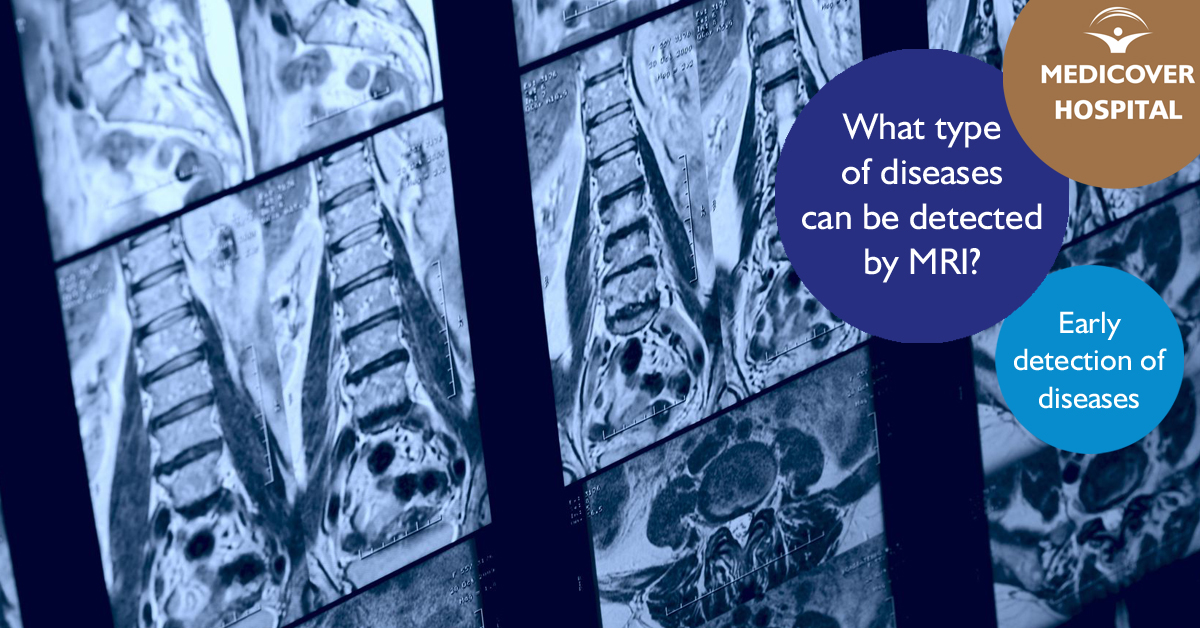 Korhaz_FB_1200x628_MRI-scan-diseases_170724
