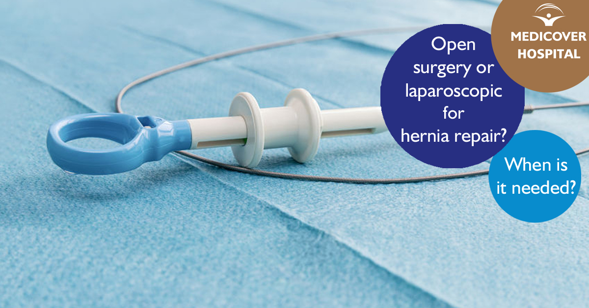 MKorhaz_FB_1200X628_laparoscopic-or-open-hernia-repair-170508