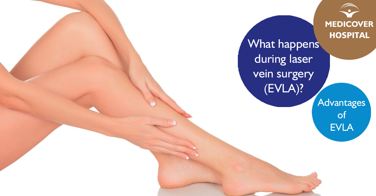 MKorhaz_FB_1200x628_EVLA-surgery_170522