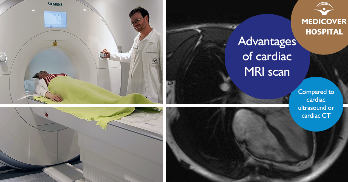 MKorhaz_FB_1200x628_advantages-cardiac-MRI-scan_171116