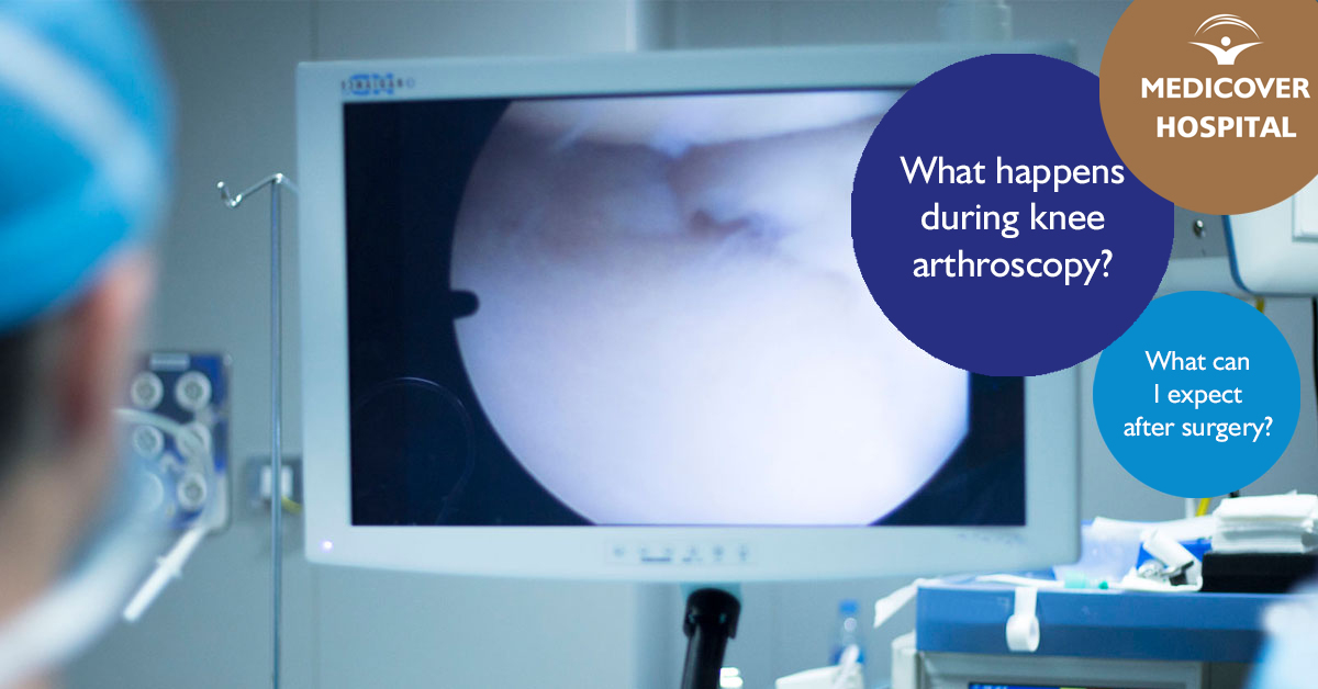 MKorhaz_FB_1200x628_arthroscopic-knee-surgery-expect-180425