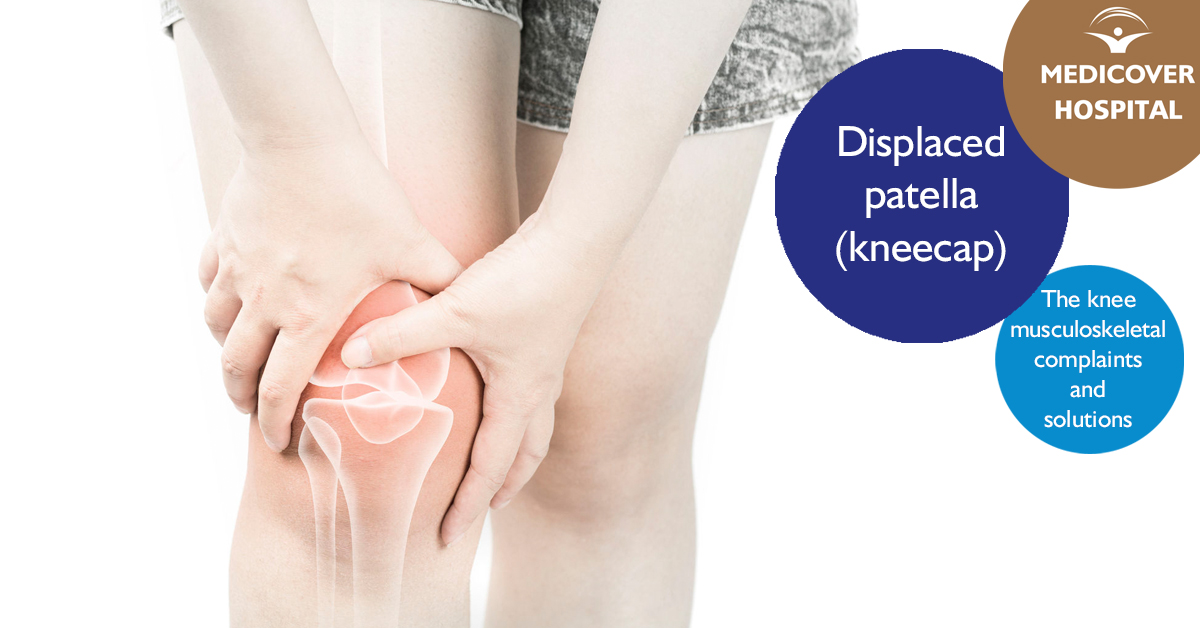 MKorhaz_FB_1200x628_displaced-patella_171026