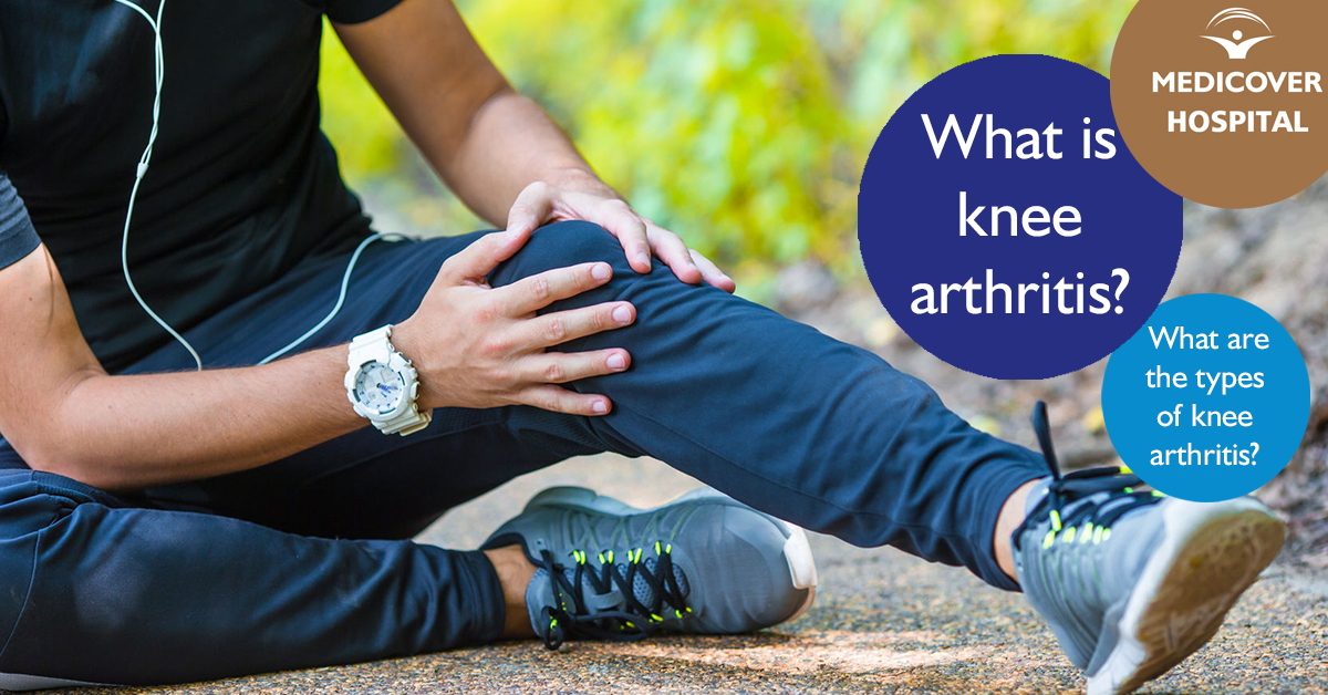 MKorhaz_FB_1200x628_knee-arthritis_171005