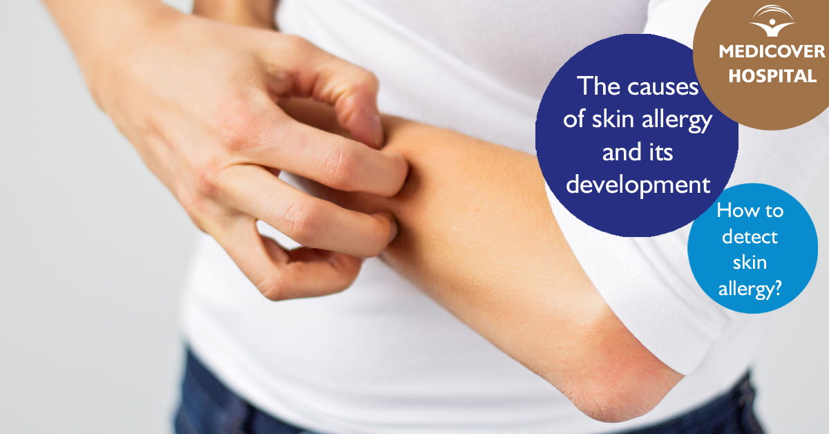 MKorhaz_FB_1200x628_skin-allergy_170818