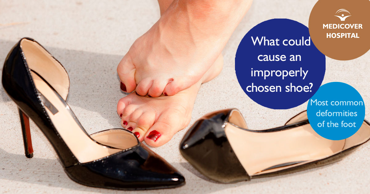 facebook-1200-628-bunion